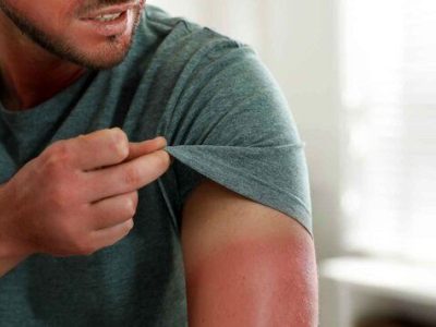وضعیت افزایش تابش اشعه فرابنفش /حداکثر تابش در مرداد