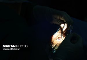 جراحیهای تخصصی چشم برای نخستینبار در مینودشت آغاز شد