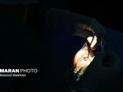 جراحیهای تخصصی چشم برای نخستینبار در مینودشت آغاز شد